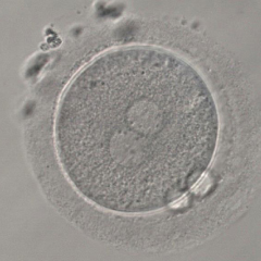 正常受精（2PN）の画像
