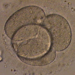 分割胚移植の画像01
