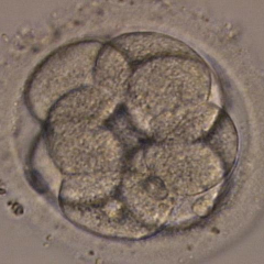 分割胚移植の画像02