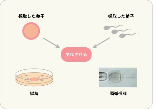 ④培養のイメージ図